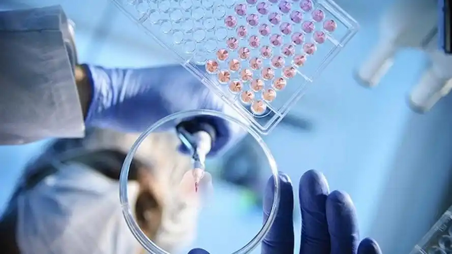 How to ensure the success rate of stem cell transplantation How to ensure the success rate of stem cell transplantation